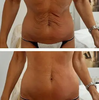 T-shape2