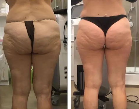 T-Shape2